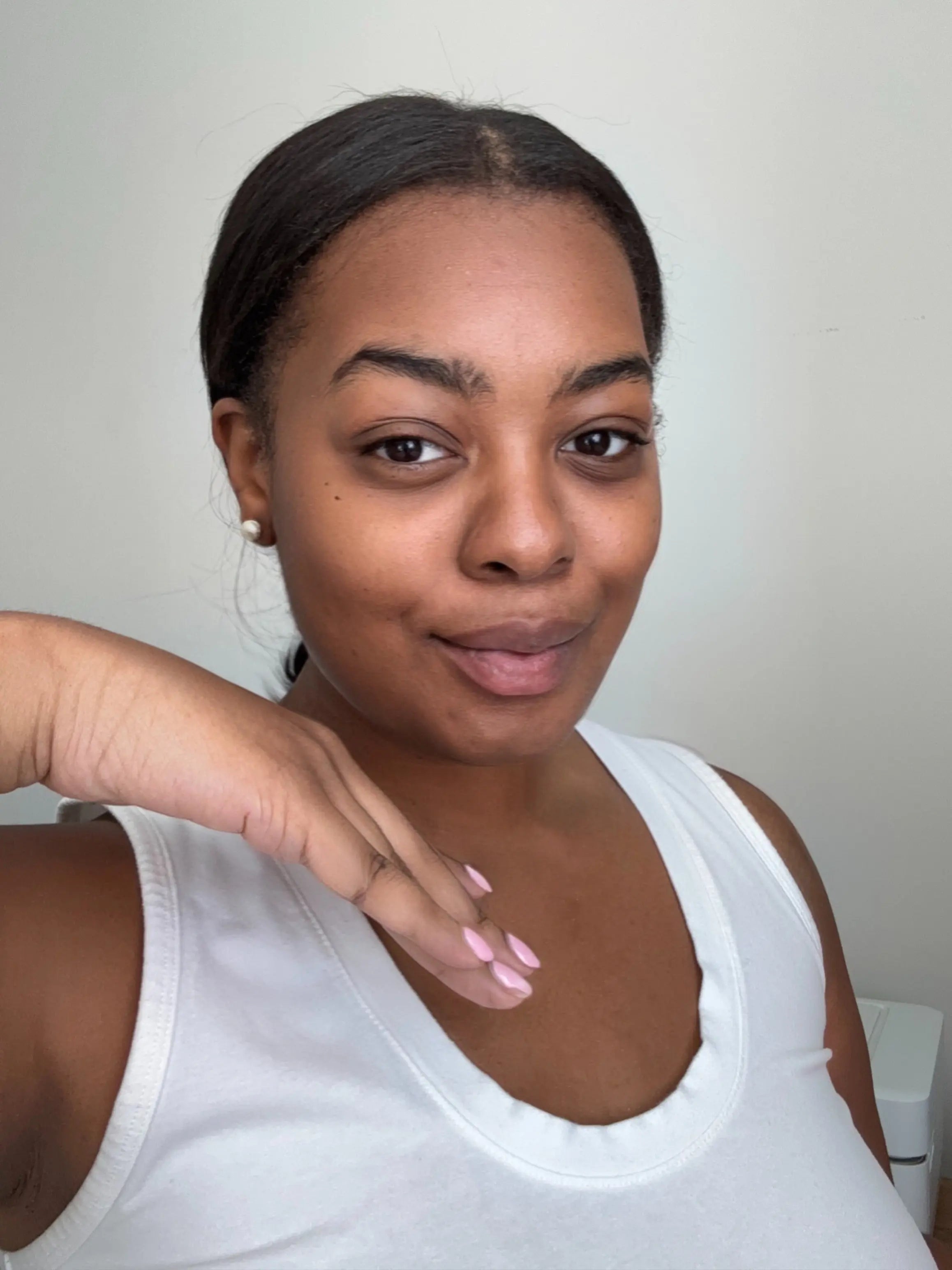 5 Ways to Prevent Pimples and Supercharge Your Glow