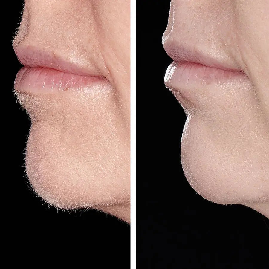 Hollywood Smoother - Sonic Dermaplaner - Hollywood Browzer