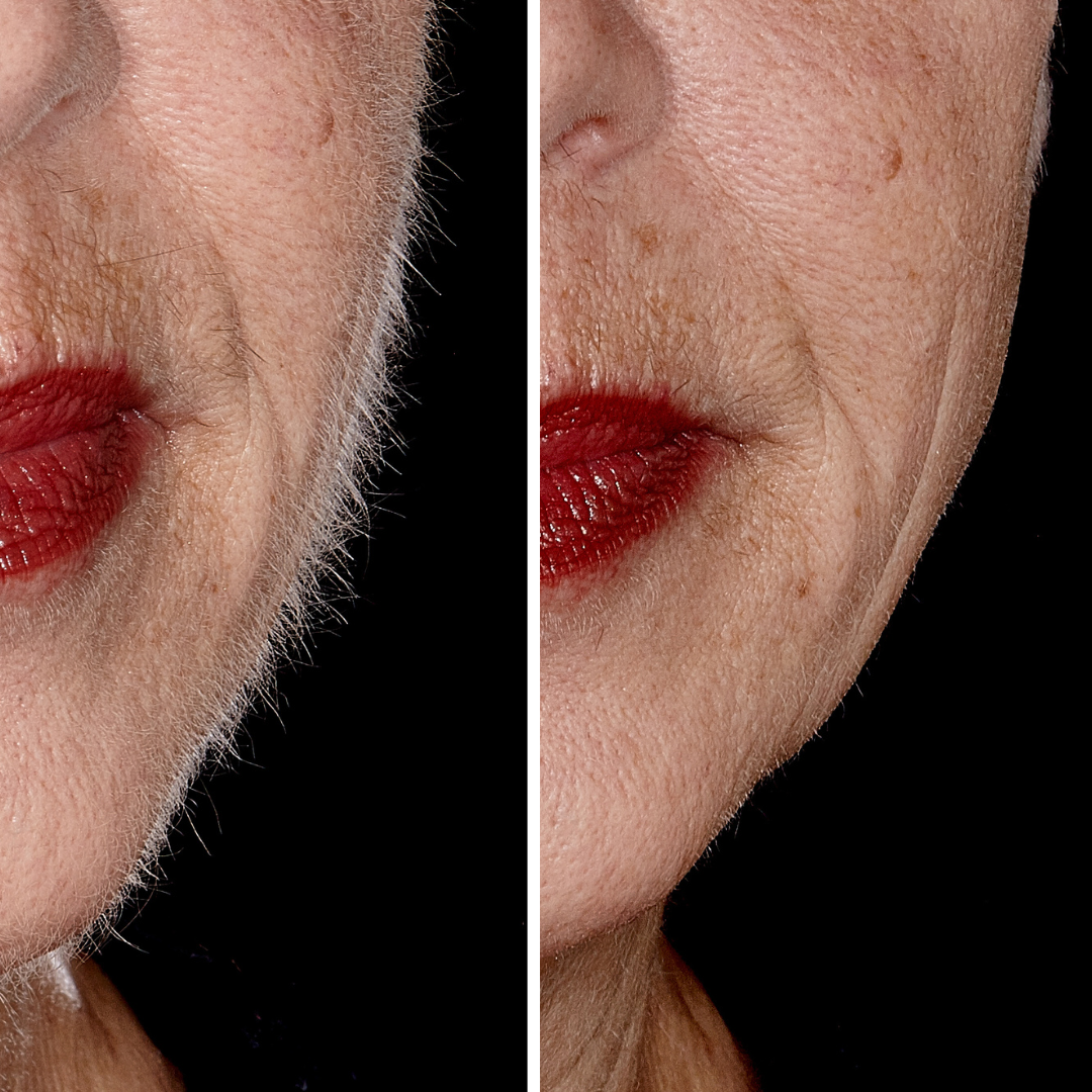Ultimate Glow Duo: The Hollywood Microplaner Set
