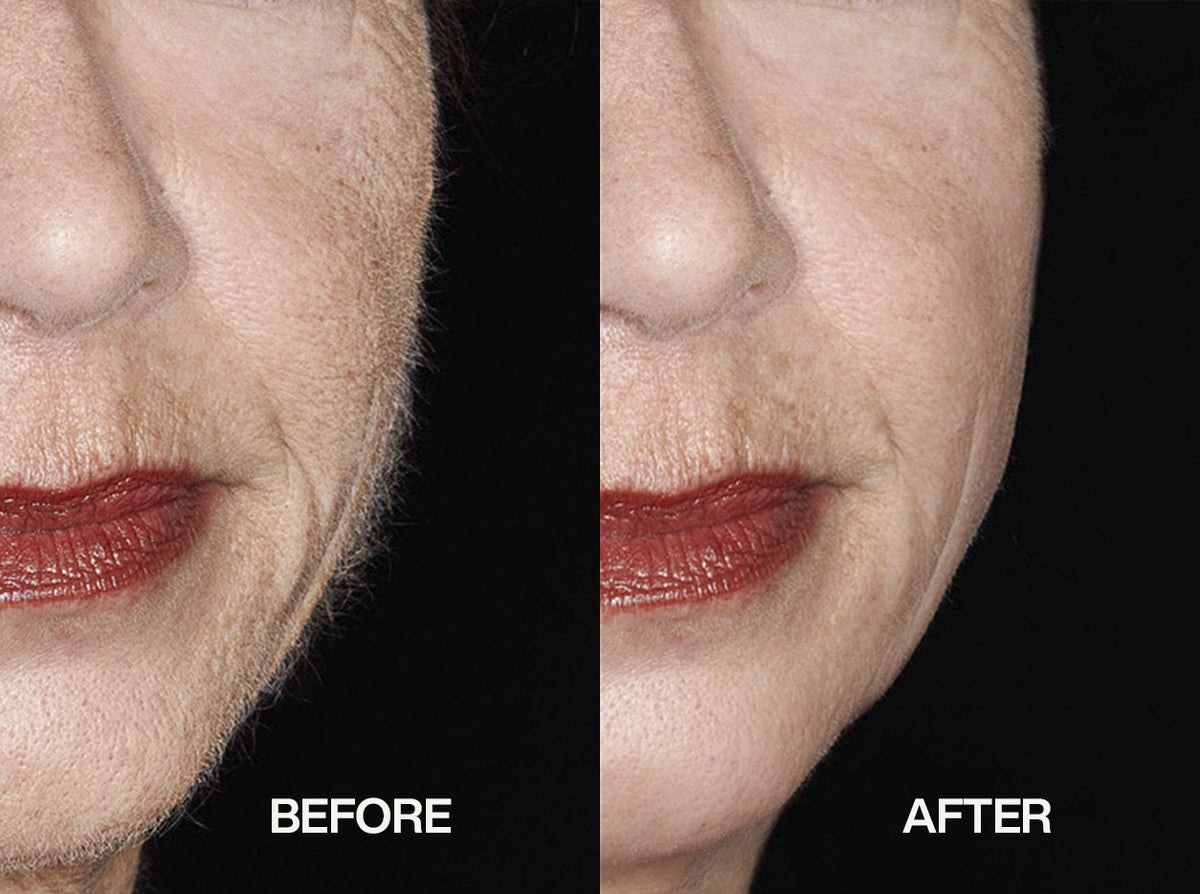 Makeup Before and after dermaplaning