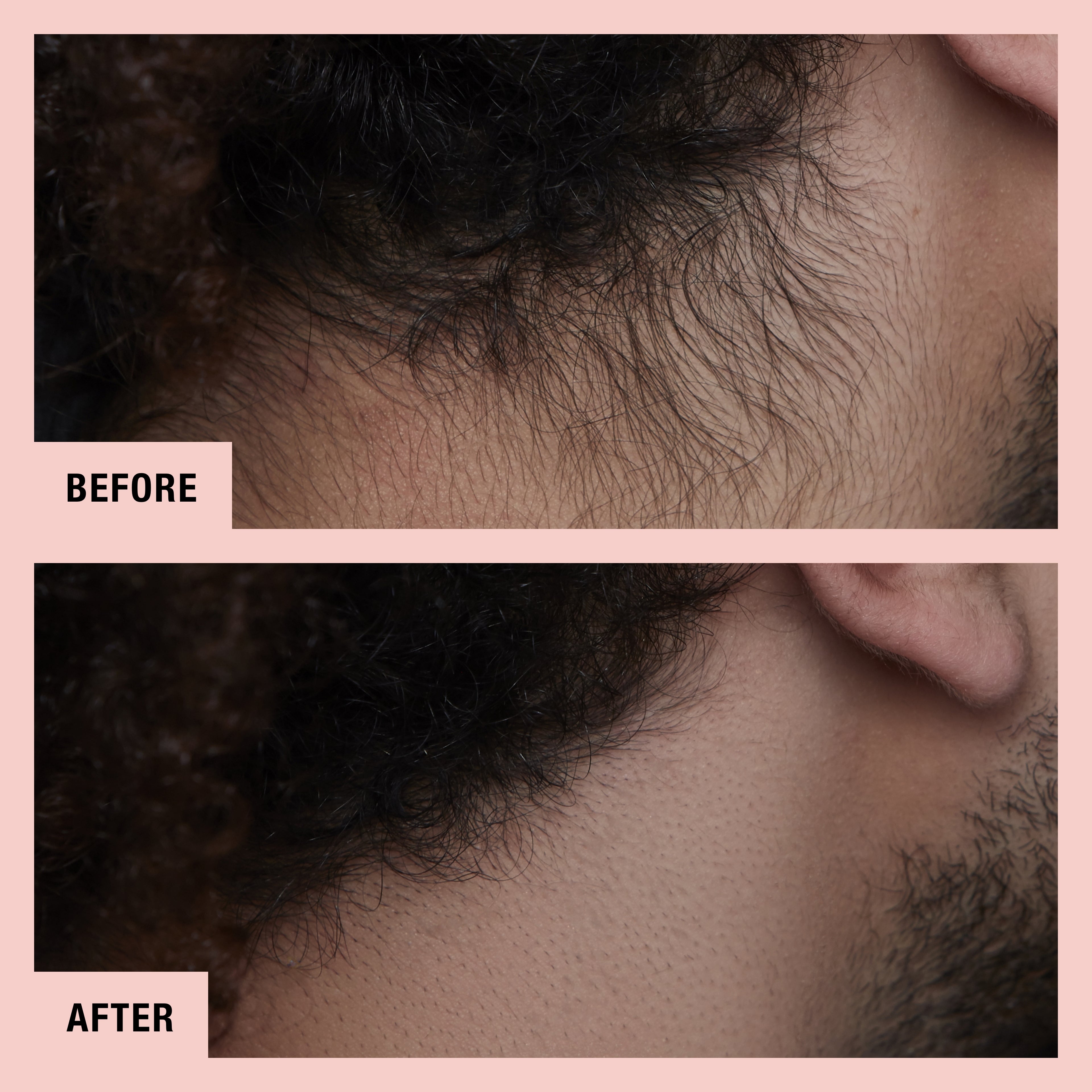 hollywood browzer neck-before and after-01