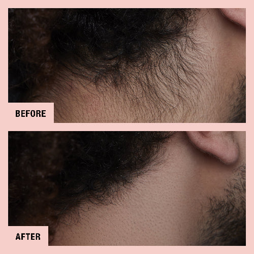 hollywood browzer neck-before and after-01