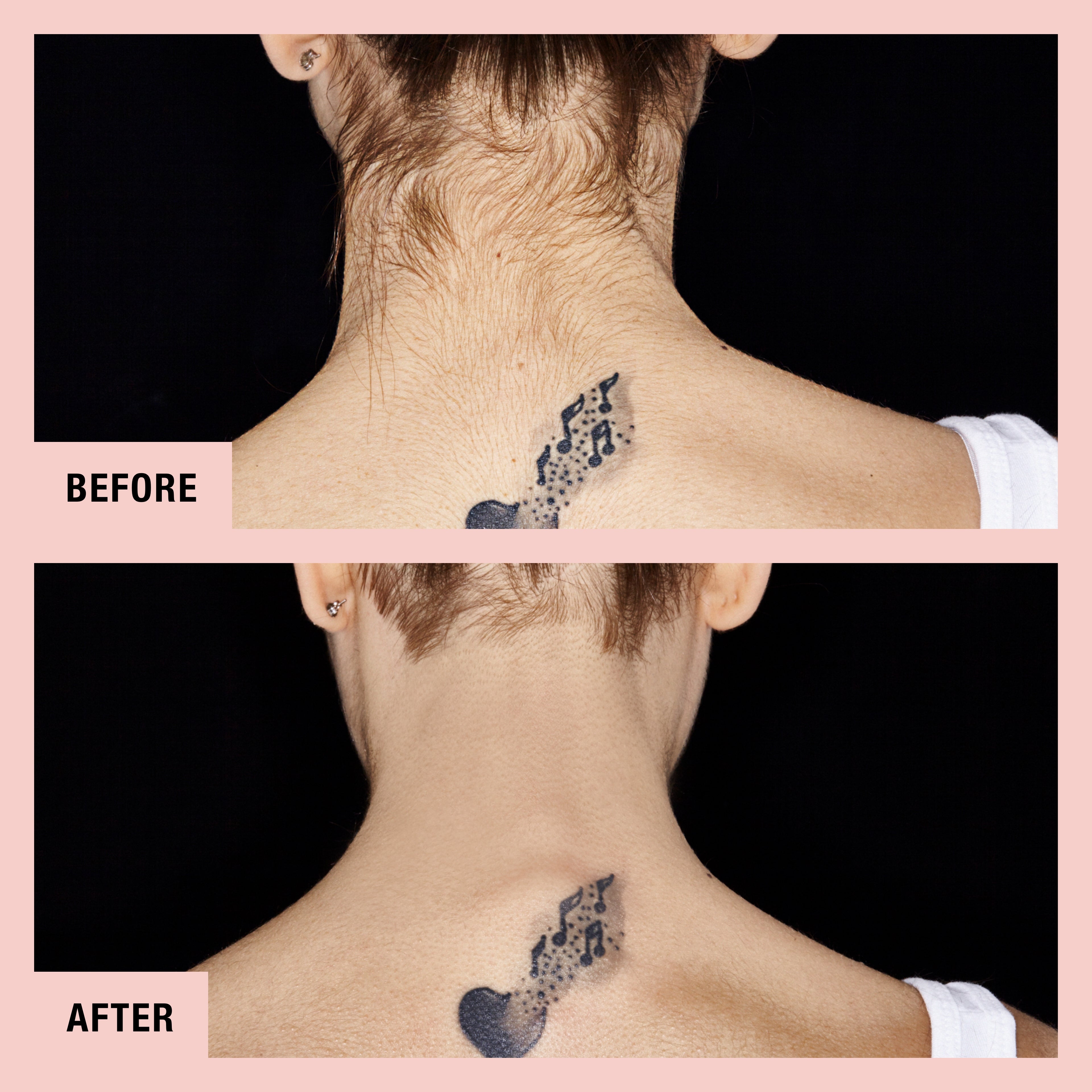 hollywood browzer neck-before and after-02
