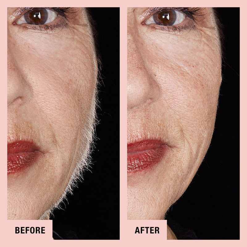 Peach fuzz on chin Clearance