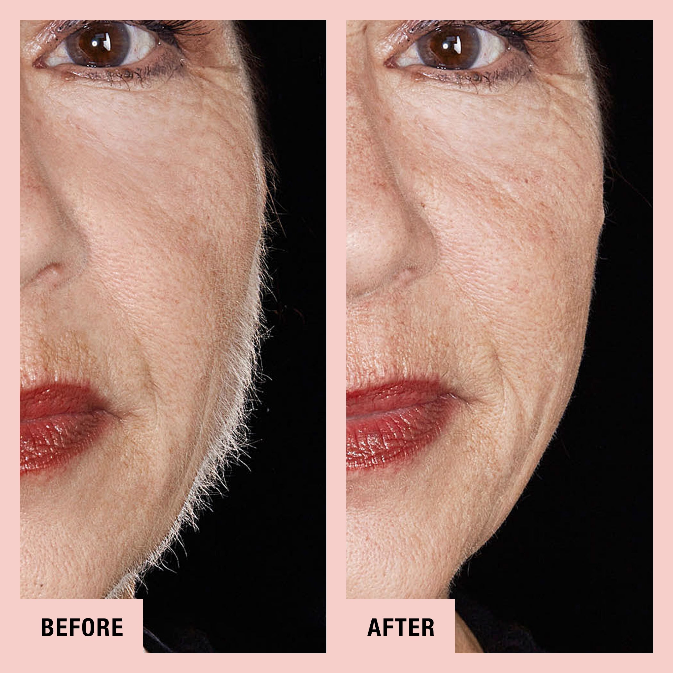 peachfuzz- before and after